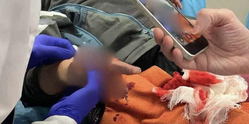 В Подмосковье школьник поднял с земли 10-рублевую купюру и лишился пальцев